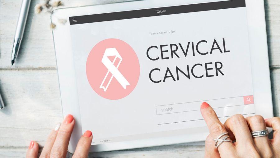 Cervical cancer